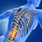 Posturas conscientes para evitar hernias discales